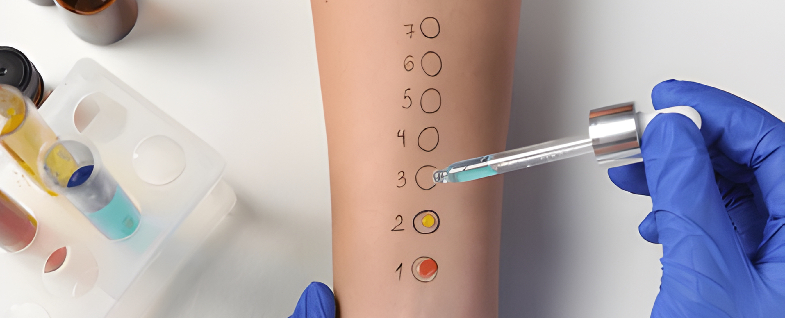 Future of Allergy Management