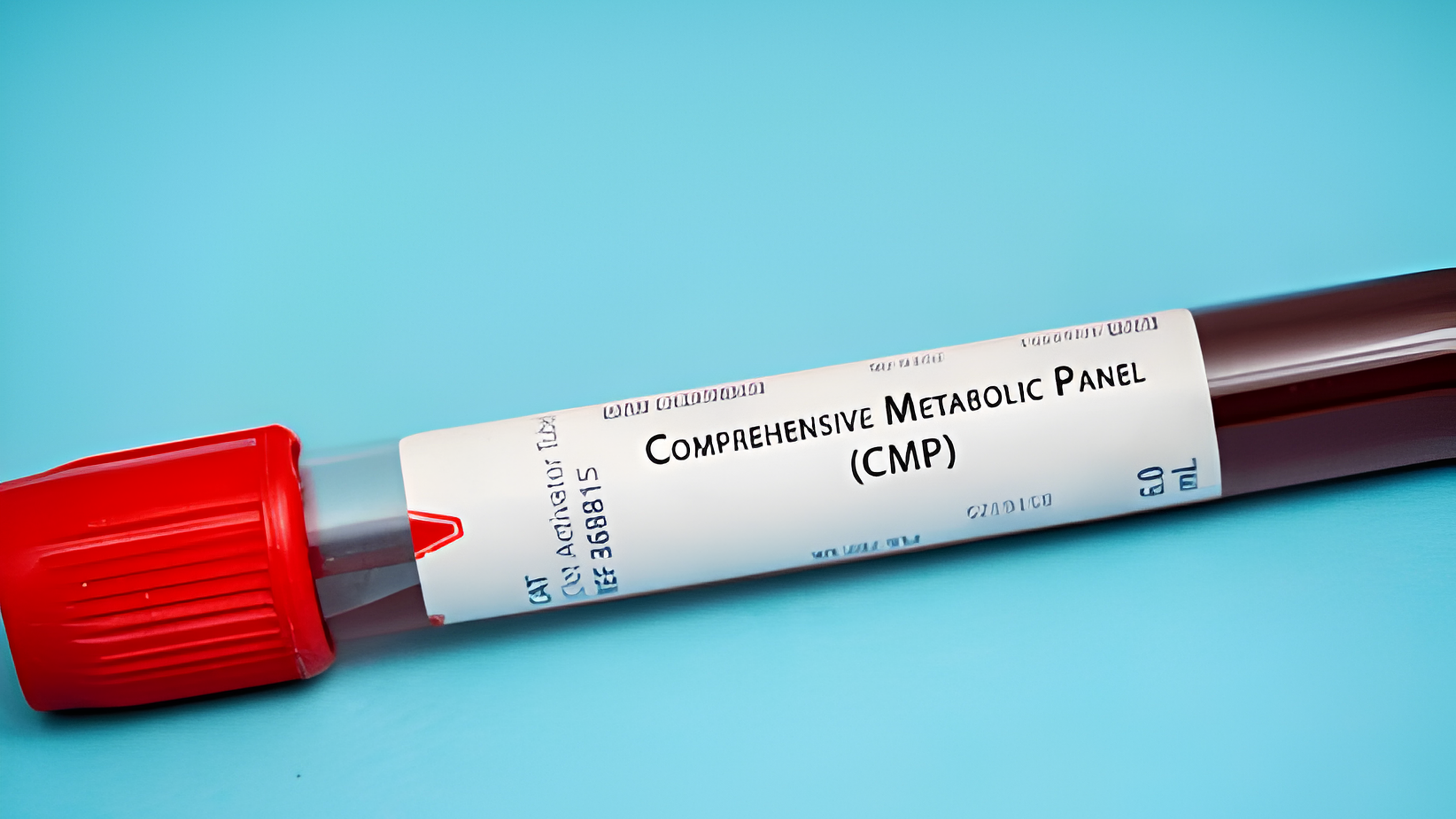 Comprehensive Metabolic Panel (CMP) in Delhi NCR: Decoding Your Body's Inner Workings