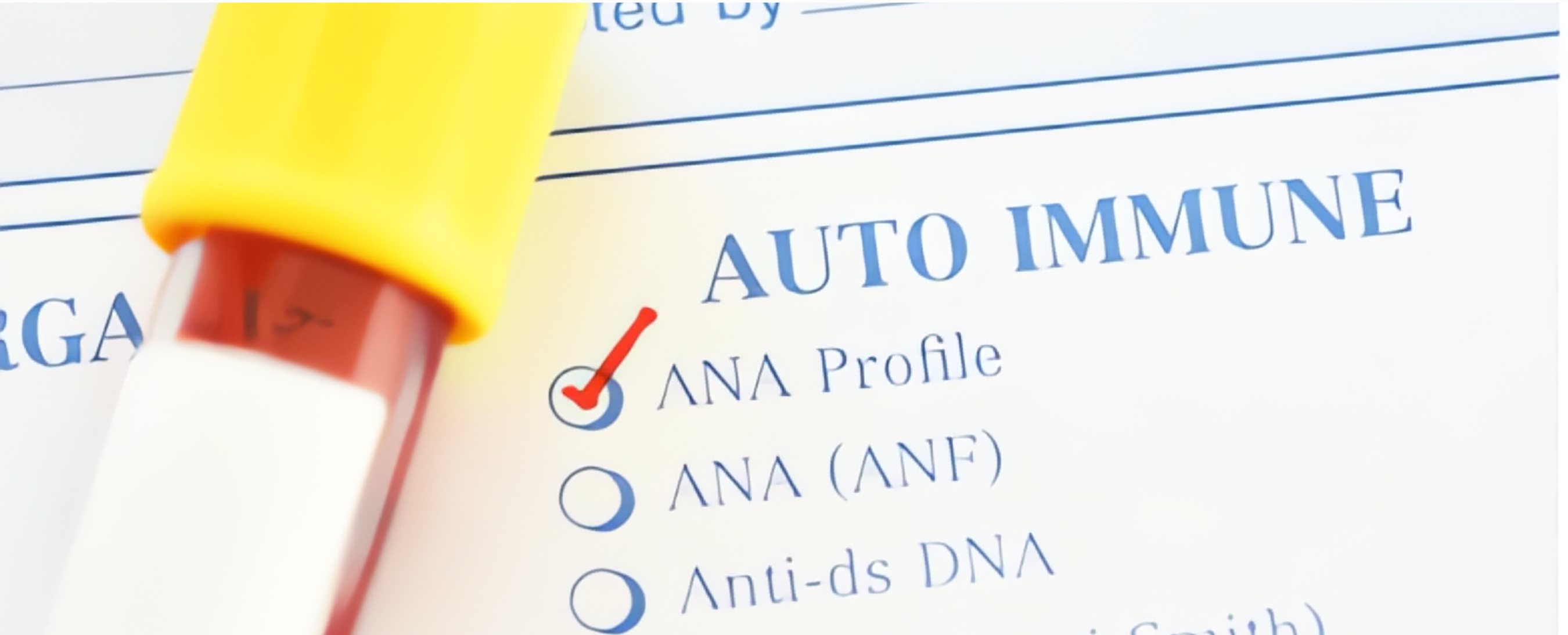 Autoimmune Conditions Overview