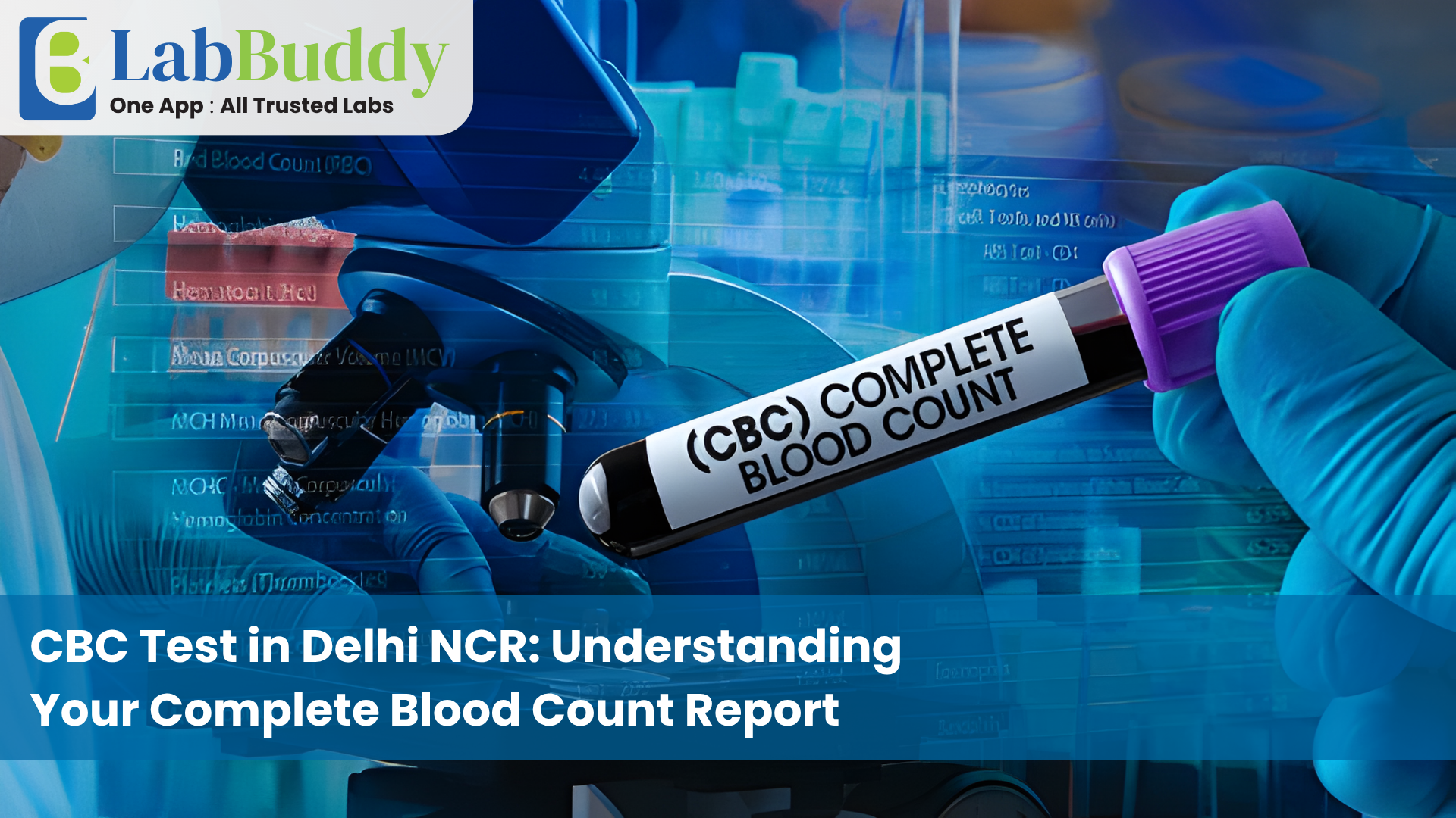 CBC Test in Delhi NCR: Understanding Your Complete Blood Count Report