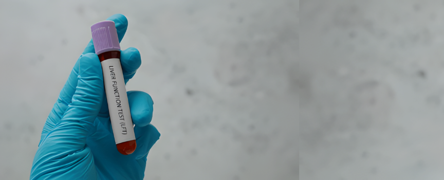 Liver Function Tests (LFT) in Delhi NCR: Complete Guide to Liver Health Assessment