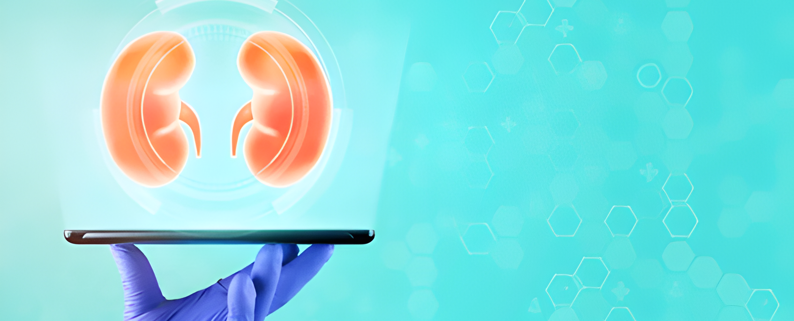 Understanding KFT Results